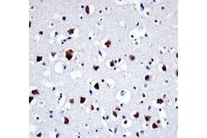 Src antibody immunohistochemistry analysis in formalin fixed and paraffin embedded human brain tissue (Src 抗体  (AA 24-52))