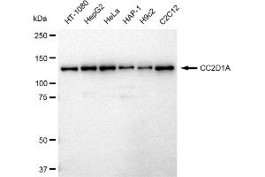 Western blotting analysis using CC2D1A antibody (ABIN7798112). (Recombinant CC2D1A 抗体)