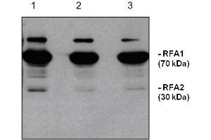 Western Blotting (WB) image for anti-Replication Protein A1, 70kDa (RPA1) antibody (ABIN190714) (RPA1 抗体)