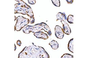 IHC analysis of RAB7/RAB7A using anti-RAB7/RAB7A antibody (ABIN7600597). (RAB7A 抗体  (AA 21-177))