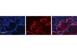 Rabbit Anti-MINA Antibody   Formalin Fixed Paraffin Embedded Tissue: Human Thyroid Tissue Observed Staining: Cytoplasm in follicular cells Primary Antibody Concentration: 1:100 Other Working Concentrations: N/A Secondary Antibody: Donkey anti-Rabbit-Cy3 Secondary Antibody Concentration: 1:200 Magnification: 20X Exposure Time: 0. (MINA 抗体  (N-Term))