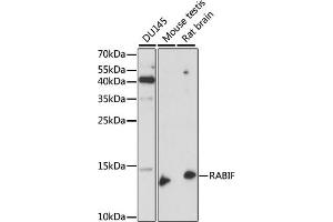 Western blot analysis of extracts of various cell lines, using RABIF antibody (ABIN7269786) at 1:1000 dilution. (RABIF 抗体  (AA 1-123))