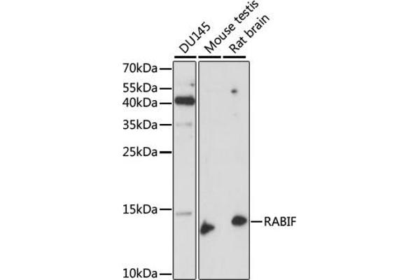 RABIF 抗体  (AA 1-123)
