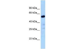Host:  Rabbit  Target Name:  Zfp84  Sample Type:  Rat Liver lysates  Antibody Dilution:  1. (ZNF84 抗体  (C-Term))