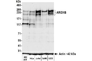 Western Blotting (WB) image for anti-AT Rich Interactive Domain 1B (SWI1-Like) (ARID1B) (AA 1425-1475) antibody (ABIN7795694) (Recombinant ARID1B 抗体  (AA 1425-1475))