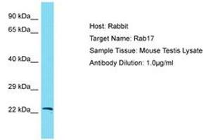 Image no. 1 for anti-RAB17, Member RAS Oncogene Family (RAB17) (AA 63-112) antibody (ABIN6750391) (RAB17 抗体  (AA 63-112))