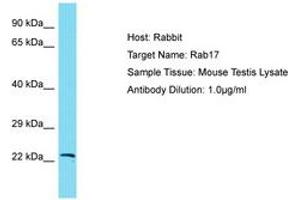 Image no. 1 for anti-RAB17, Member RAS Oncogene Family (RAB17) (AA 63-112) antibody (ABIN6750391) (RAB17 抗体  (AA 63-112))