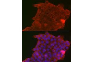 Immunofluorescence analysis of A-431 cells using PIGR Rabbit pAb (ABIN6128562, ABIN6145618, ABIN6145620 and ABIN6221728) at dilution of 1:150 (40x lens). (PIGR 抗体  (AA 661-764))