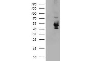 Western Blotting (WB) image for anti-Potassium Voltage-Gated Channel, Shaker-Related Subfamily, beta Member 1 (KCNAB1) antibody (ABIN1498999) (KCNAB1 抗体)