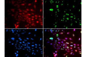 Immunofluorescence analysis of GFP-RNF168 transgenic U2OS cell using L3MBTL1 antibody. (L3MBTL1 抗体)