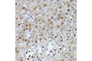 Immunohistochemistry of paraffin-embedded human esophagus using S100 Rabbit pAb (ABIN3015803, ABIN3015804, ABIN3015805, ABIN1682607 and ABIN6219148) at dilution of 1:100 (40x lens). (S100A10 抗体  (AA 1-97))