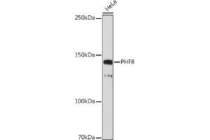 Western blot analysis of extracts of HeLa cells, using PHF8 antibody (ABIN7269263) at 1:1000 dilution. (PHF8 抗体)