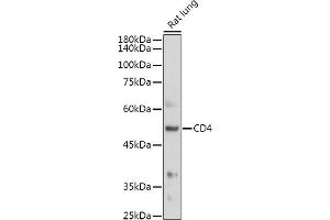 Western blot analysis of extracts of Rat lung, using CD4 antibody (ABIN6134777, ABIN6138187, ABIN6138189 and ABIN6213821) at 1:500 dilution. (CD4 抗体  (AA 300-400))
