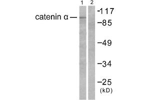 Western blot analysis of extracts from HeLa cells, using Catenin- alpha antibody. (CTNNA1 抗体  (C-Term))