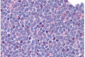 Human Tonsil: Formalin-Fixed, Paraffin-Embedded (FFPE) (SIP1 抗体  (C-Term))