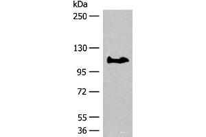 Western blot analysis of PC-3 cell lysate using GARNL3 Polyclonal Antibody at dilution of 1:400 (GARNL3 抗体)