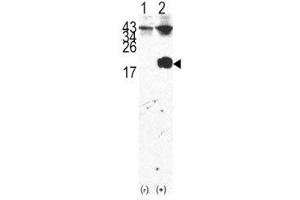 Western blot analysis of FKBP12 antibody and 293 cell lysate either nontransfected (Lane 1) or transiently transfected with the FKBP12 gene (2). (FKBP1A 抗体  (AA 43-74))