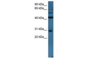 Image no. 1 for anti-T-Cell Leukemia Homeobox 2 (TLX2) (N-Term) antibody (ABIN6746163) (TLX2 抗体  (N-Term))