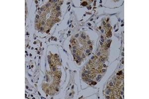 Immunohistochemistry of paraffin-embedded human normal stomach using TNFRSF6B antibody at dilution of 1:200 (400x lens). (TNFRSF6B 抗体)