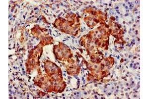 Immunohistochemistry of paraffin-embedded human pancreatic tissue using ABIN7171509 at dilution of 1:100 (TARDBP 抗体  (AA 1-396))