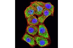 Immunofluorescence (IF) image for anti-Vascular Cell Adhesion Molecule 1 (VCAM1) (AA 25-183) antibody (ABIN5684062)