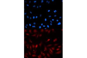 Immunofluorescence analysis of U2OS cells using PA2G4 antibody.