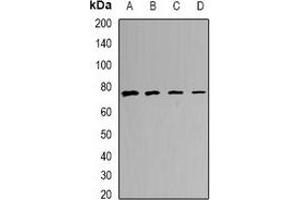 Western blot analysis of CALCOCO1 expression in MCF7 (A), A549 (B), mouse lung (C), mouse heart (D) whole cell lysates. (CALCOCO1 抗体)