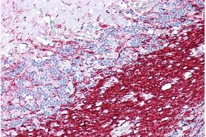 Immunohistochemistry with Brain, cerebellum tissue at an antibody concentration of 5µg/ml using anti-PLP1 antibody (ARP33843_P050) (PLP1 抗体  (N-Term))
