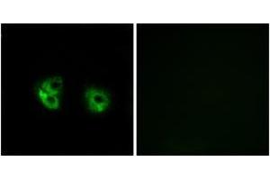 Immunofluorescence analysis of A549 cells, using MARCH2 Antibody. (MARCH2 抗体  (AA 191-240))