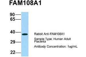 Host: Rabbit  Target Name: FAM108A1  Sample Tissue: Human Adult Placenta  Antibody Dilution: 1. (ABHD17A 抗体  (C-Term))