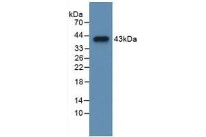 Detection of Recombinant CCK, Mouse using Polyclonal Antibody to Cholecystokinin (CCK) (Cholecystokinin 抗体  (AA 1-115))