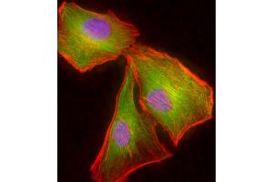 Immunofluorescent analysis of 4 % paraformaldehyde-fixed, 0. (TUBB2A 抗体  (AA 194-225))