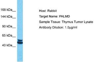 Host: Rabbit Target Name: PALMD Sample Tissue: Human Thymus Tumor Antibody Dilution: 1ug/ml (PALMD 抗体  (Middle Region))