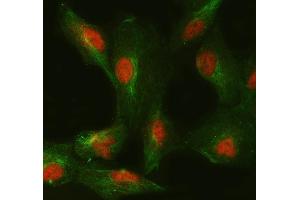 IF analysis of SMC6 and Tubulin beta using anti-SMC6 antibody (ABIN7601864) and anti-Tubulin beta antibody (ABIN7602744).