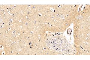 Immunohistochemistry (IHC) image for anti-Interleukin 10 Receptor, alpha (IL10RA) (AA 132-235) antibody (ABIN7433870)