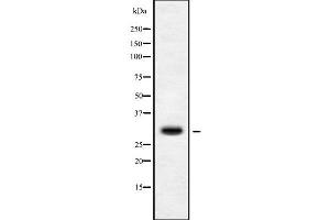 Western blot analysis of MRPS15 using Jurkat whole cell lysates (MRPS15 抗体  (Internal Region))