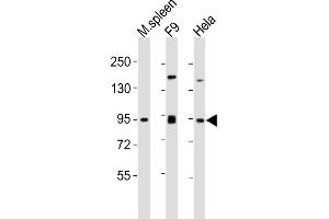 All lanes : Anti-SUZ12 Antibody (Center) at 1:2000 dilution Lane 1: mouse spleen lysates Lane 2: F9 whole cell lysates Lane 3: Hela whole cell lysates Lysates/proteins at 20 μg per lane. (SUZ12 抗体  (AA 375-408))