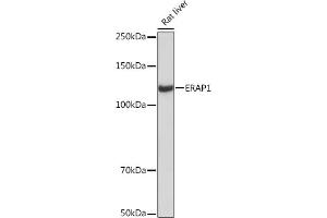 Western blot analysis of extracts of Rat liver, using ER Rabbit mAb (ABIN7266941) at 1:1000 dilution. (ERAP1 抗体)