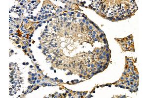 Phospho-DYR1A (Tyr449) Antibody at 1/100 staining Mouse testis tissue by IHC-P. (DYRK1A 抗体  (pTyr449))
