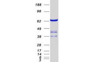 Western Blotting (WB) image for SWAP Switching B-Cell Complex 70kDa Subunit (SWAP70) protein (Myc-DYKDDDDK Tag) (ABIN2733021)