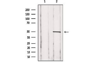Western blot analysis of extracts from Mouse spleen, using GDI2 Antibody. (GDI2 抗体  (Internal Region))