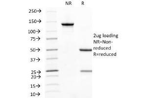 SDS-PAGE Analysis Purified CD31 Mouse Monoclonal Antibody (C31. (CD31 抗体)
