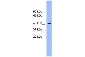 WB Suggested Anti-CSNK1A1L Antibody Titration: 0. (CSNK1A1L 抗体  (Middle Region))