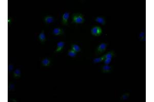Immunofluorescence staining of MCF7 Cells with ABIN7127404 at 1:50, counter-stained with DAPI. (Recombinant CD47 抗体)