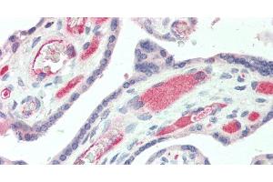 Immunohistochemistry of paraffin-embedded Human Placenta using IBSP Polyclonal Antibody at dilution of 1:50. (IBSP 抗体)