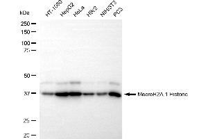 Western blotting analysis using MacroH2A. (Recombinant Histone, H2A1, Macro 抗体)