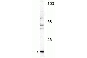 Western blot of rat cerebellar lysate showing specific immunolabeling of the ~29 kDa calretinin protein.