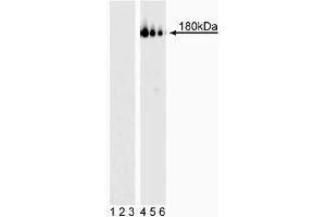 Western blot analysis of PDGFRbeta (pY857). (PDGFRB 抗体  (pTyr857))