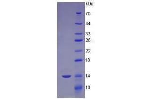 SDS-PAGE analysis of Human Cubilin Protein. (CUBN 蛋白)