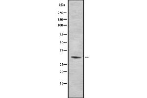 Western blot analysis of Ribosomal Protein S2 using HeLa whole cell lysates (RPS2 抗体  (C-Term))